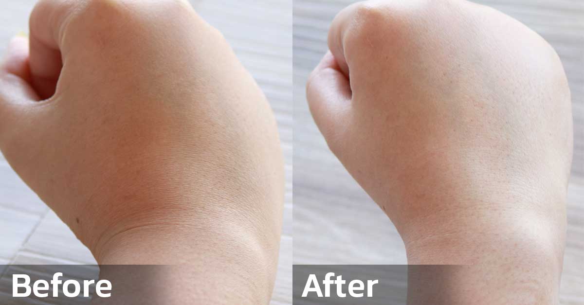 JUV Serum Vit C