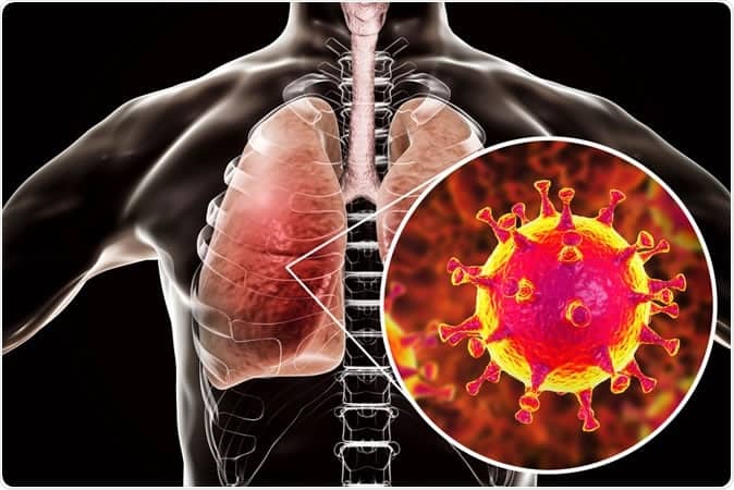 ไวรัสโคโรน่าสายพันธุ์ใหม่-2019-lung