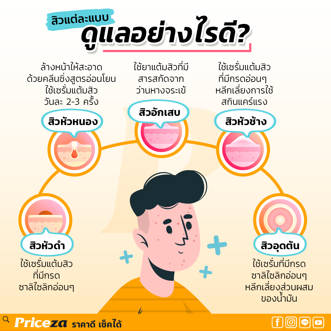 วิธีรักษาสิว