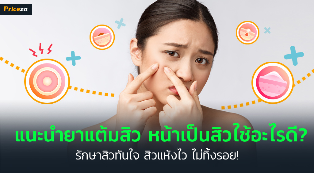 10 ยาแต้มสิว ยี่ห้อไหนดี? ครีมแต้มสิวใช้ดี สิวยุบหายไวแบบไร้รอยแดง!